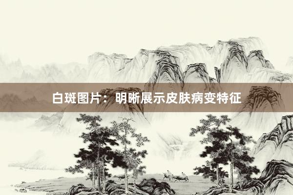 白斑图片：明晰展示皮肤病变特征